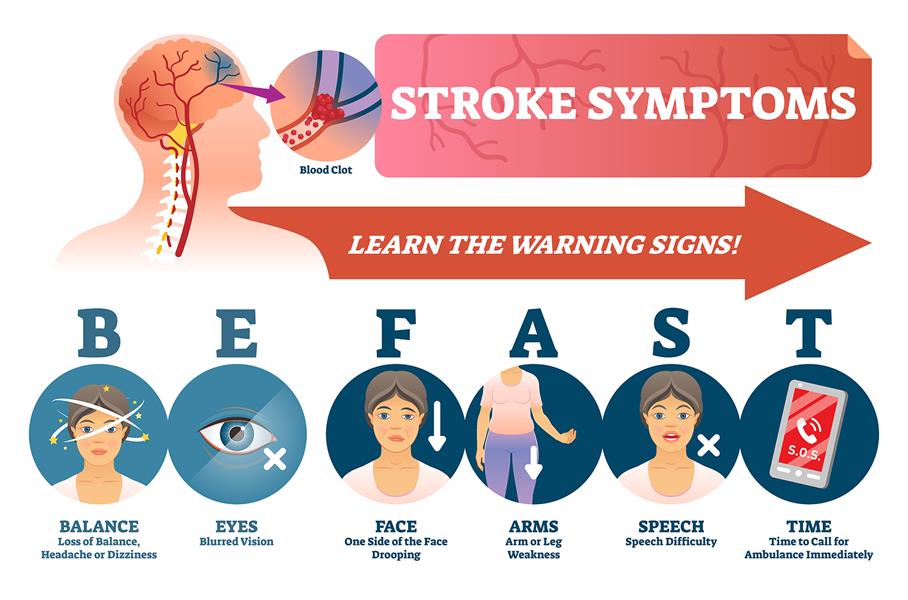 Early Warning Signs of Stroke You Should Never Ignore